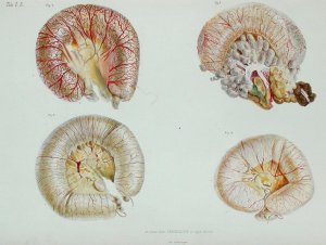 The external surface of the intestines infected with cholera, from 'Anatomie Pathologique du Cholera Morbus', by Nikolai Ivanovich Pirogov 1810-81 published in St. Petersburg, 1849